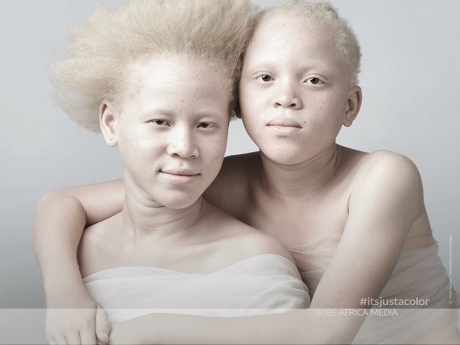 See Why This Albino Photo Shoot In Cameroon Has Gone Viral By Tribe Africa Media Page Of
