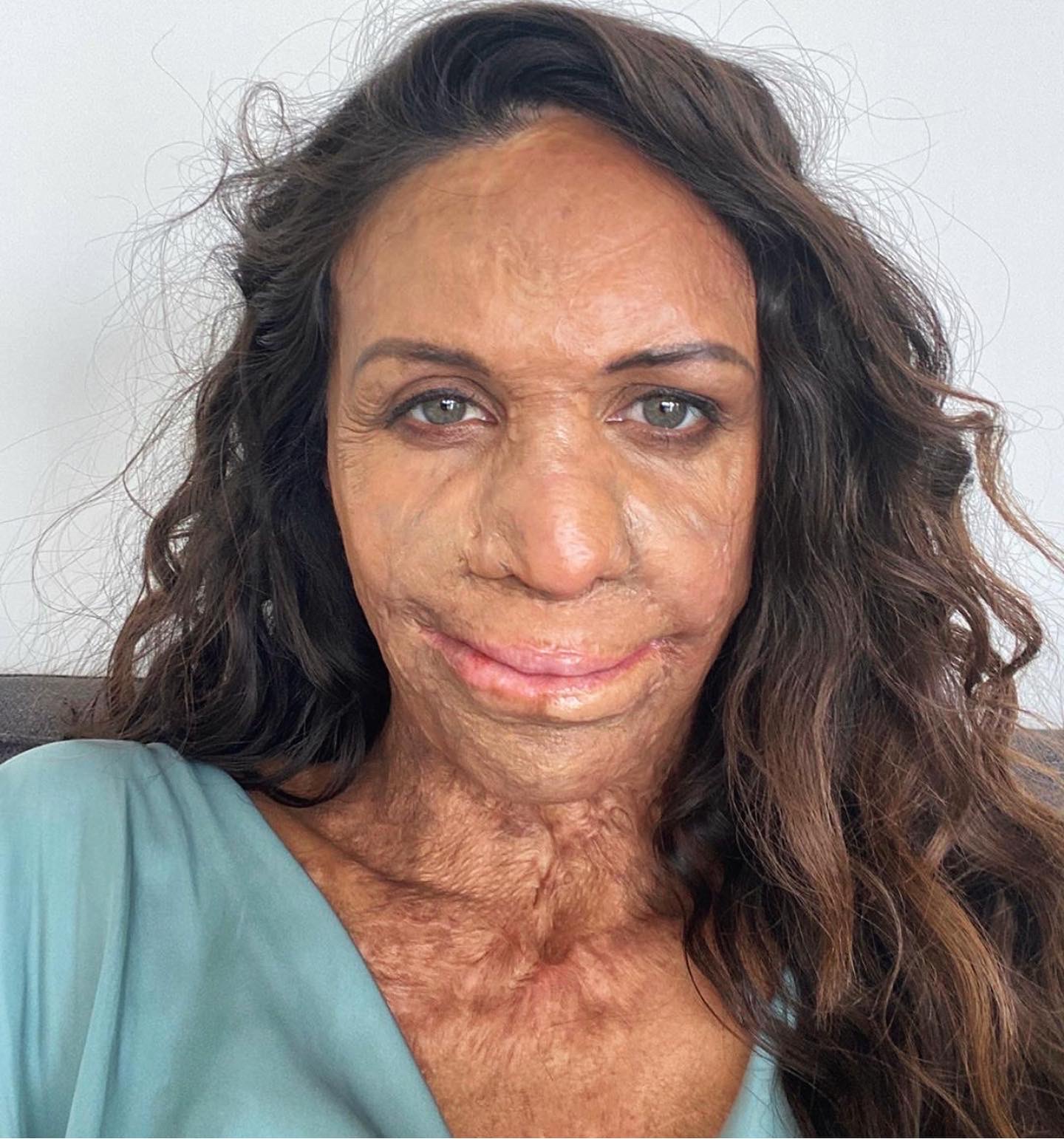 How Burn Survivor Turia Pitt Thought Me About Being Confident The Hotjem 1 Pan African Media Outlet For News Pop Culture Trends