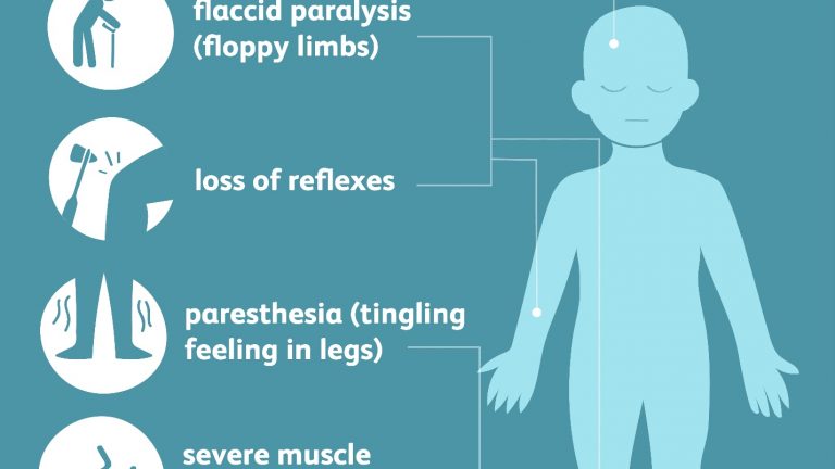 Symptoms of Poliomyelitis in children
